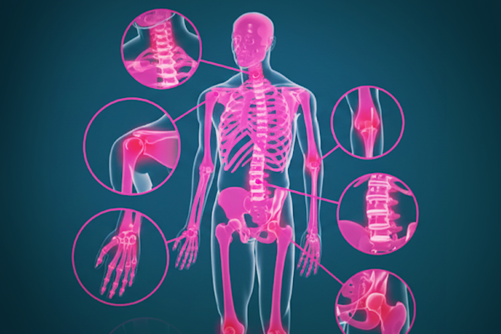 Douleurs arthrose, hernie ou tendinite